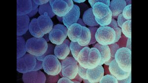 alaskan-woman-s-death-highlights-rising-concerns-over-gonorrhea-strains