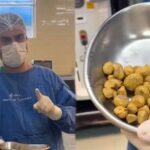 indian-man-develops-35-kidney-stones-from-excessive-soda-consumption