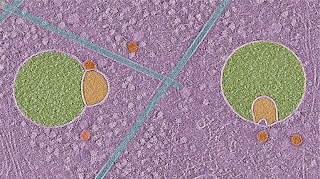 new-organelle-discovery-hemifusomes-unveil-hidden-pathways-in-human-cells