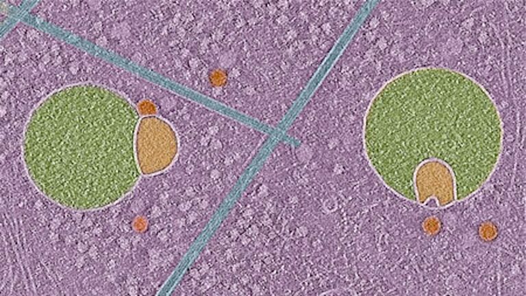 new-organelle-discovery-hemifusomes-unveil-hidden-pathways-in-human-cells