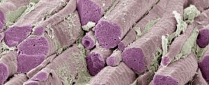 oral-diabetes-drug-promises-fewer-side-effects-challenges-ozempic
